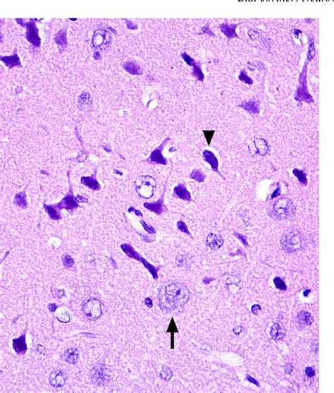 Figure From The Return Of The Dark Neuron A Histological Artifact