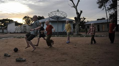 Malawi S Albinos At Risk Of Total Extinction U N Warns Cnn