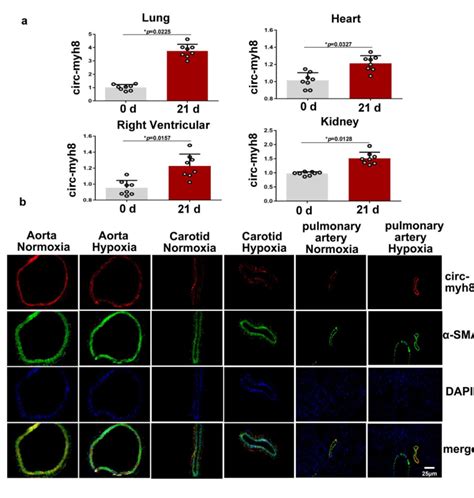 Figure S2 Circ Myh8 Expression In Tissues From Hypoxic PH Mice