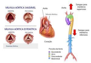 Série Explorando as doenças cardiovasculares por simulações