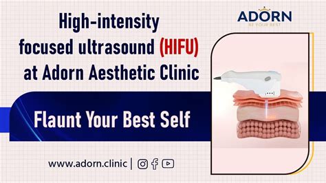 High Intensity Focused Ultrasoundhifu At Adorn Aesthetic Best