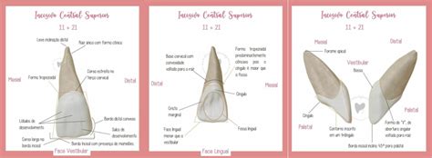 Incisivo Central Superior Mapa Mental Anatomia E Escultura Dental