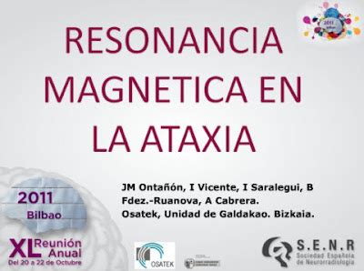 ataxia y atáxicos Resonancia magnética en la ataxia