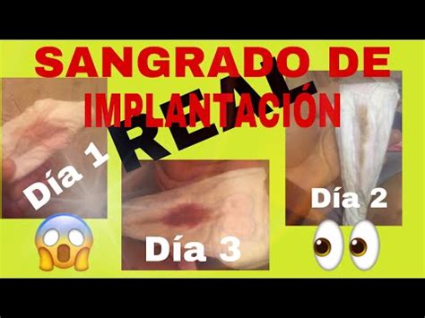 SANGRADO DE IMPLANTACIÓN FOTOS REALES posible YouTube