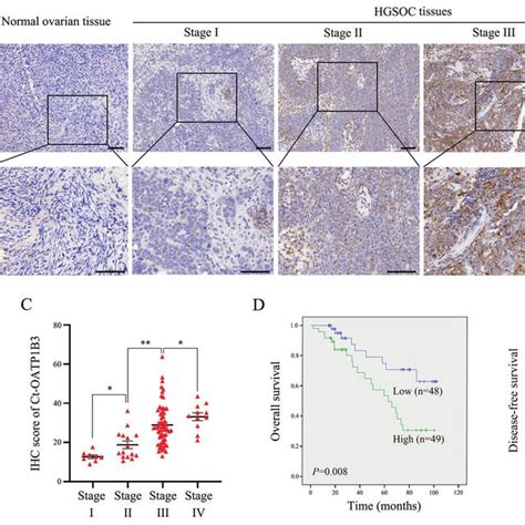 Ct OATP1B3 Directly Interacts With IGF2BP2 In HGSOC Cells A B Venn