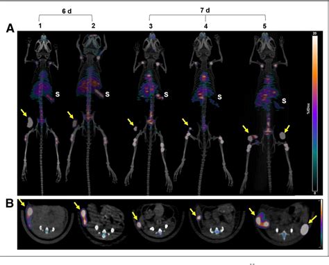 Figure From Preclinical Development Of Cd Targeted Zr Zr Dfo