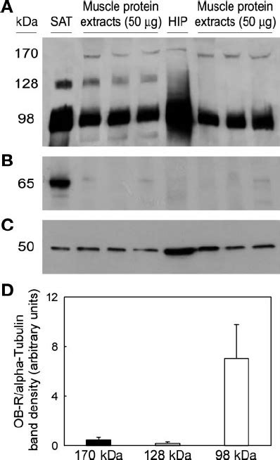 Determination Of The Expression Of Human Leptin Receptor Ob R In