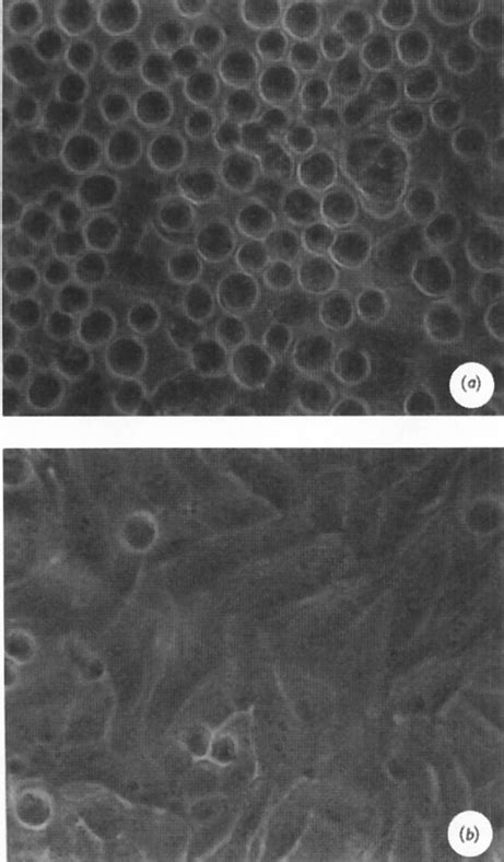 The Anti Adhesion Effect Of Episialin Download Scientific Diagram