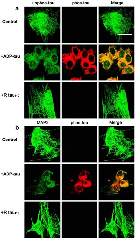 Co Localization Of AD P Tau With Normal Tau And MAP2 In Noco Tri Cells