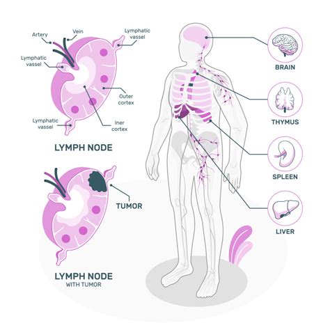 Sentinel Lymph Node Biopsy Dr Mahesh