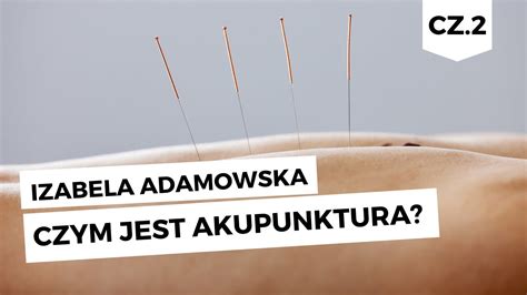 Czym Jest Akupunktura Cz Izabela Adamowska Lawendowy Bazar