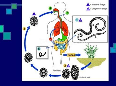 Helminths infection - YouTube