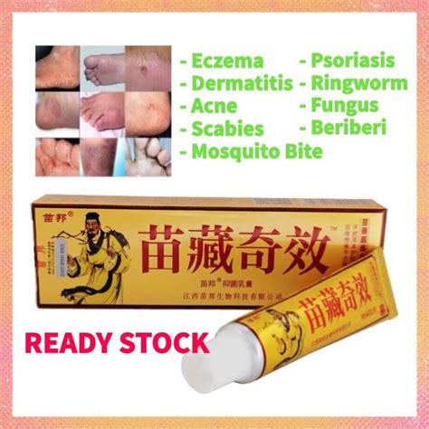 Eczema Psoriasis Beriberi Fungus 100 Chinese Herbal Cream Ubat Gatal