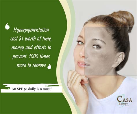 Best Hyperpigmentation Treatment Singapore JYUNKA FACIALS