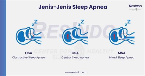 Jenis Jenis Sleep Apnea Resindo Medika