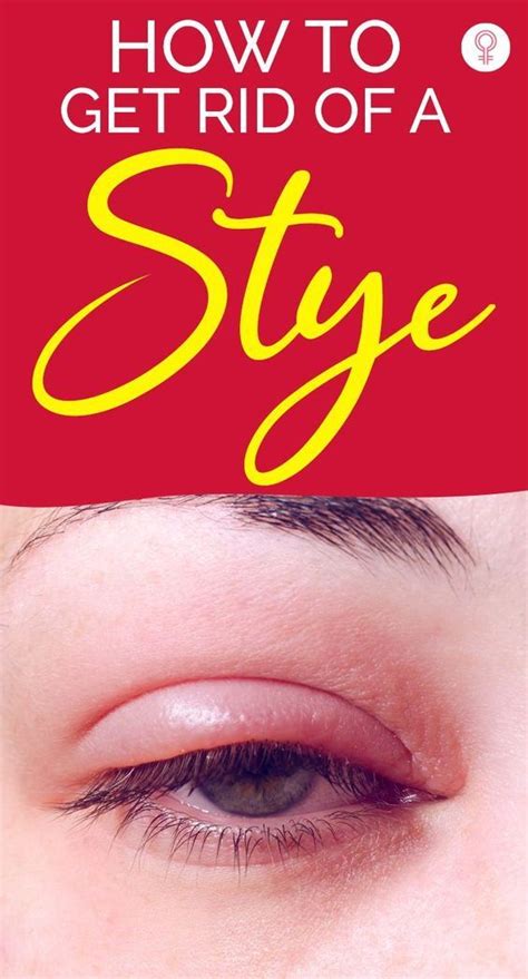 Pin On Eye Styes