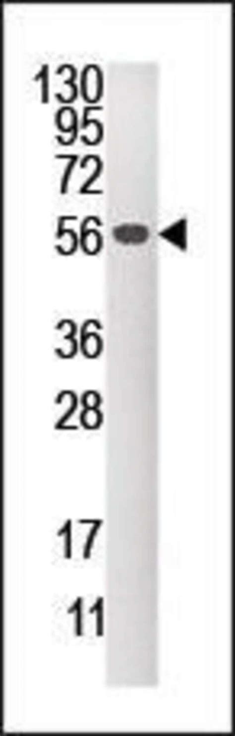 MKP2 Polyclonal Antibody Invitrogen 400 μL Unconjugated Anticuerpos