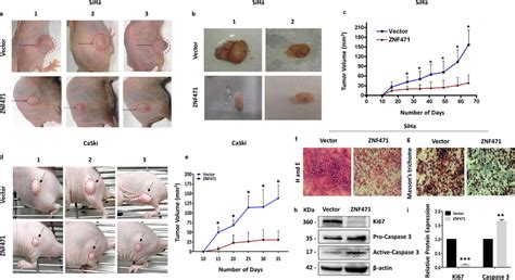 Znf Inhibits Tumor Growth In Vivo In Nude Mice A Images Of Tumor