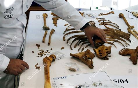 Forensic Scientist Examines Human Remains Forensics Editorial Stock ...