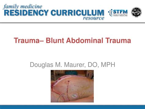 Blunt Abdominal Trauma Signs And Symptoms Assistpolf