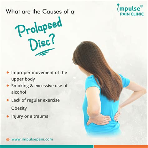 What are the Causes of a Prolapsed Disc? - Impulse Pain Clinic