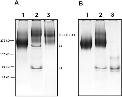 Non Denaturing Polyacylamide Gel Electrophoresis N Page Of Normal And Download Scientific