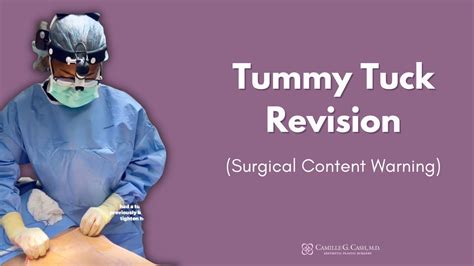 Can A Tummy Tuck Be Covered By Medicaid At Bethany Lee Blog