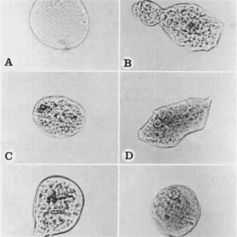 Entamoeba Trophozoites With Cytoplasmic Polyp Grains Cytochemically Download Scientific Diagram