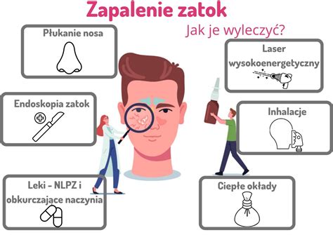 Zapalenie zatok OBJAWY Jak wyleczyć LASER NA ZATOKI