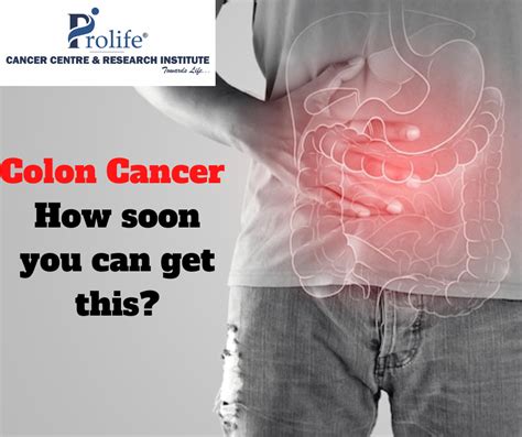 Colon Cancer How Soon You Can Get This Prolife Cancer Centre