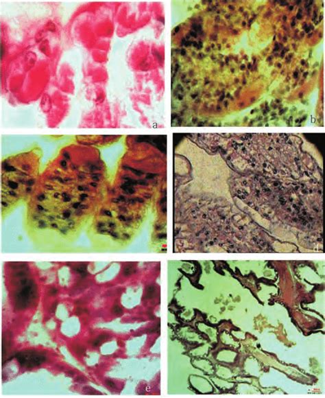 Histological Observation Of Severely Wssv Infected L Vannamei Shrimps