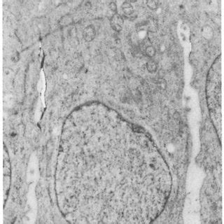 Electron Microscopical Autoradiography Of Liposomal H Dppc After