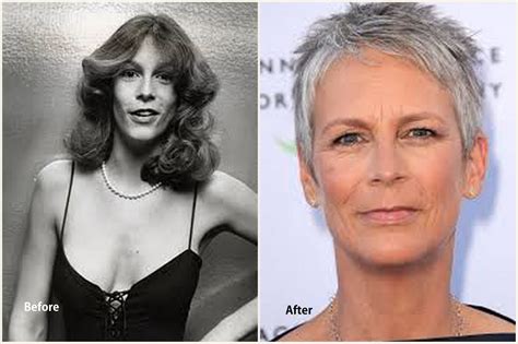 Jamie Lee Curtis Plastic Surgery Before and After Photo | Surgery News