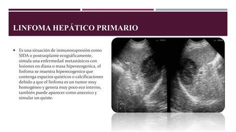 Patologías hepaticas pptx Patologías hepaticas pptx