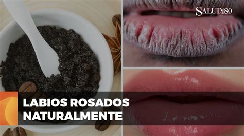 Cómo ACLARAR los labios oscuros naturalmente Salud180 YouTube