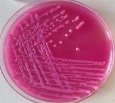 Klebsiella On Macconkey Agar