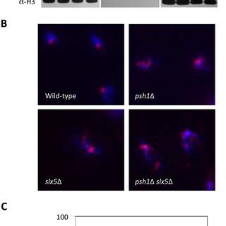 The STUbL Slx5 Interacts With Cse4 And Regulates Ubiquitin Mediated