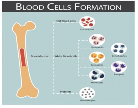 Microcytic Anemia Flashcards Quizlet