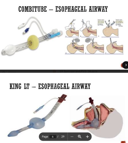 Em Intubation Airway Management Oxygen Ventilation Flashcards Quizlet