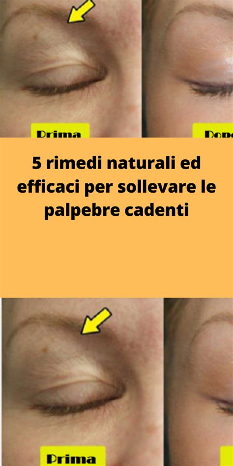 Rimedi Naturali Ed Efficaci Per Sollevare Le Palpebre Cadenti