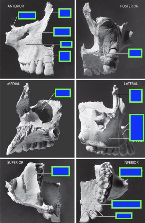 Bones of the Viscerocranium: Maxillae Diagram | Quizlet