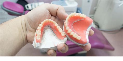 Qu Son Las Pr Tesis H Bridas Sobre Implantes Dentales P Rez Moreira