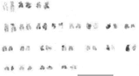 Photograph of metaphase spreads; (a) Metaphase plate, (b) Karyogram Bar ...