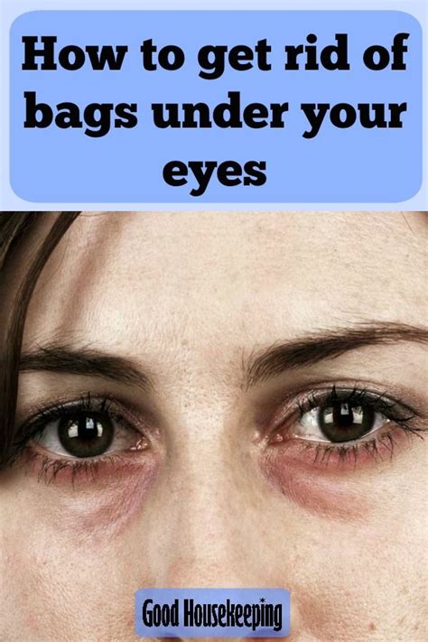 How to get rid of bags under your eyes | Dark circles under eyes, Eye care, Dark under eye