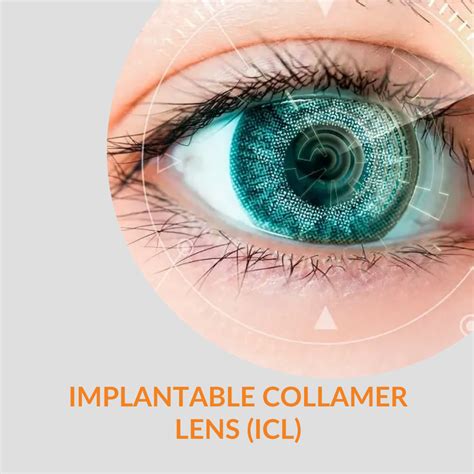 Centre For Implantable Collamer Lens Surgery L ICL Surgery