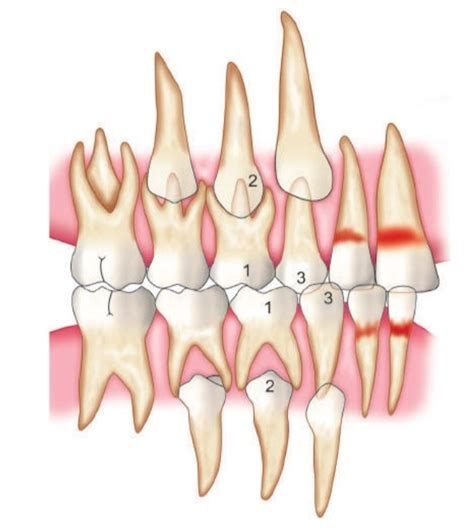 Serial Extraction Dentalbyhadeel Thread From هديل 🕊 Hadeel7m