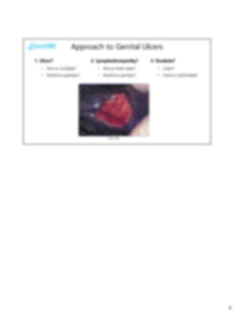 SOLUTION: Genital ulcers 2 - Studypool