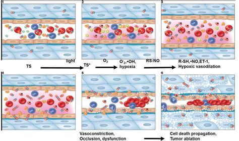 Les bases scientifiques solides de la Photothérapie Dynamique de Prostate