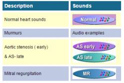 Heart – Systole and Diastole