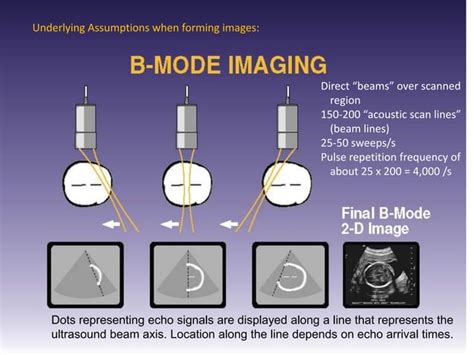 Reverberation Artifacts In Ultrasound Imaging Ppt